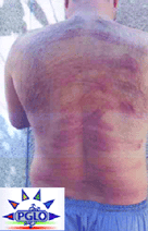 Kidnapped: Torture in Iran