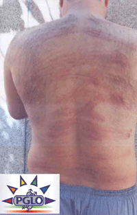 Another Gay Iranian Torture Victim Tells His Horrifying Story