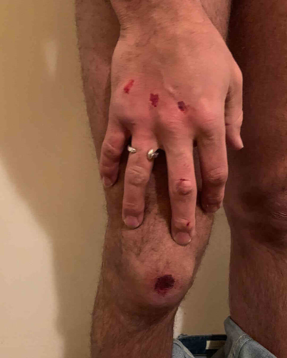 Gay Couple Alleges Homophobic Assault By Uber Driver|Gay Couple Alleges Homophobic Assault By Uber Driver